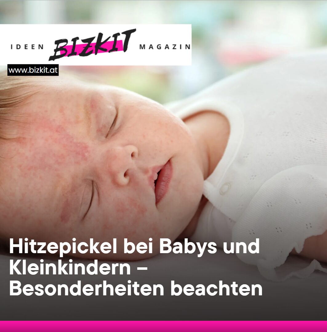Hitzepickel bei Babys und Kleinkindern – Besonderheiten beachten
