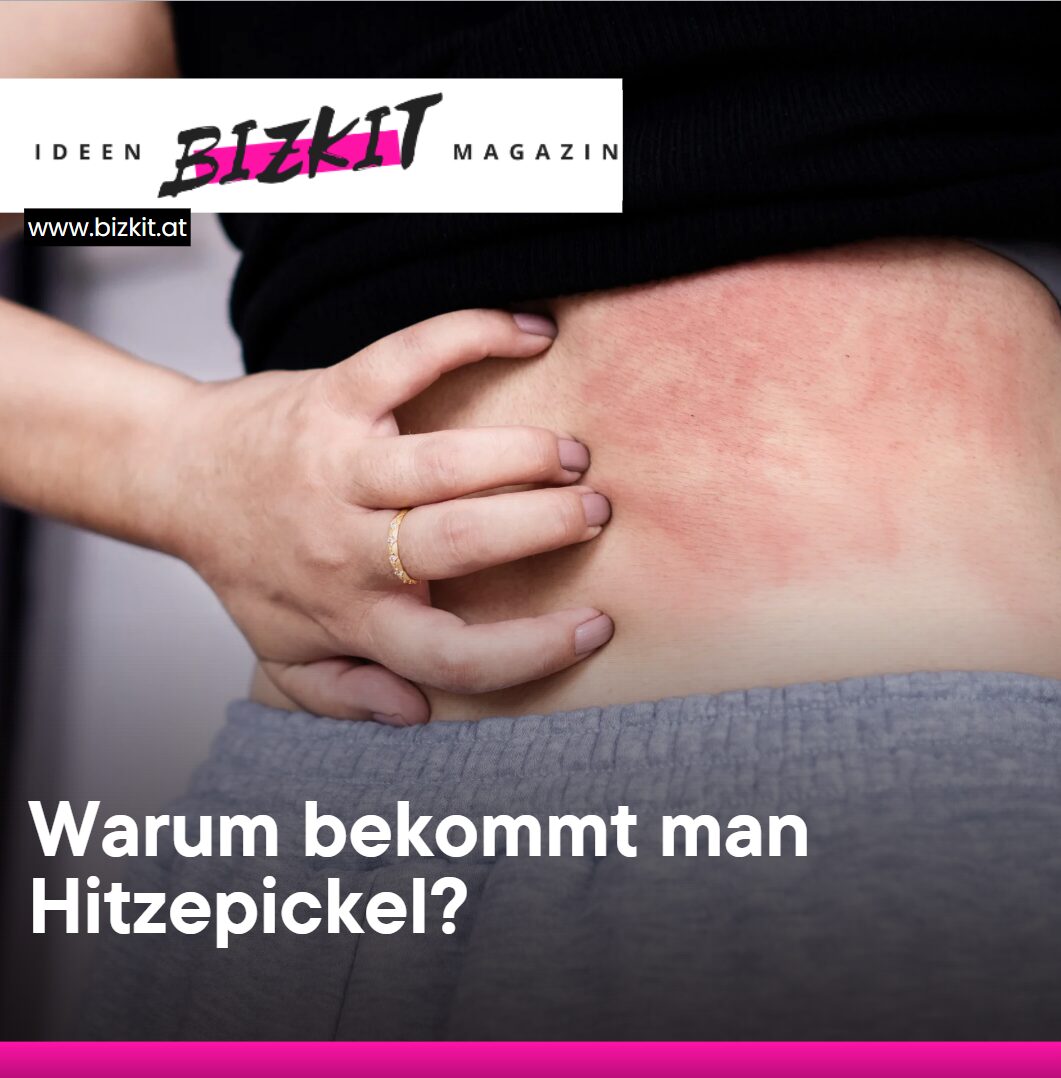 Warum bekommt man Hitzepickel