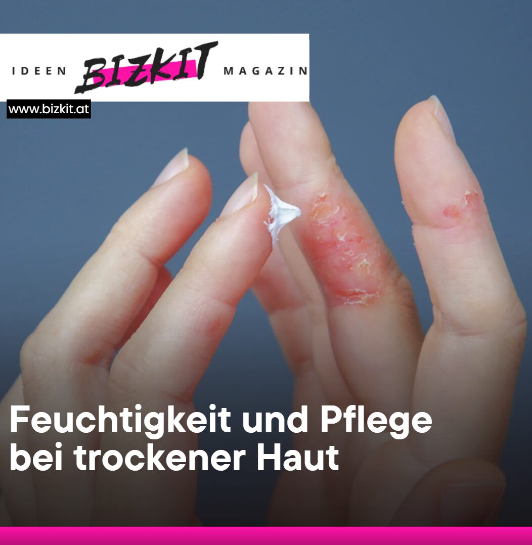Beste Salbe gegen Schuppenflechte  Feuchtigkeit und Pflege bei trockener Haut