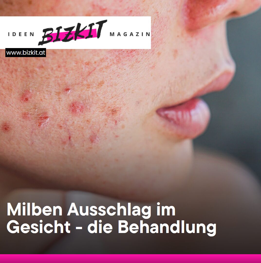 Milben Ausschlag im Gesicht - die Behandlung