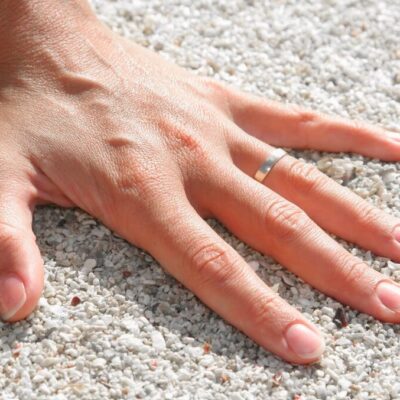 finger plötzlich geschwollen und schmerzt
