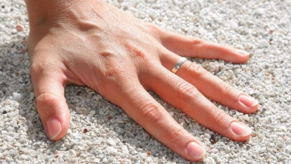 finger plötzlich geschwollen und schmerzt