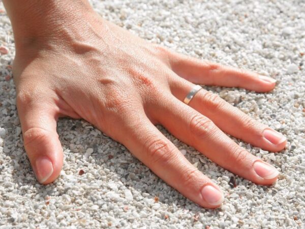 finger plötzlich geschwollen und schmerzt