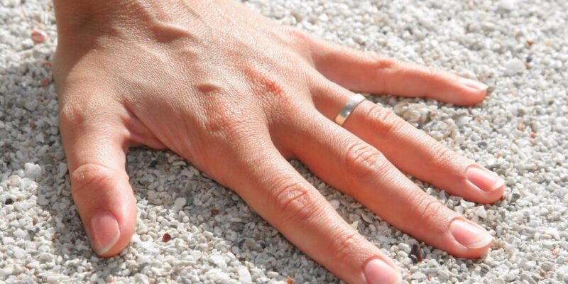 finger plötzlich geschwollen und schmerzt